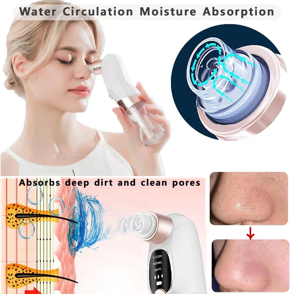 Electric Blackhead Remover Vacuum - Pore Face Cleaner